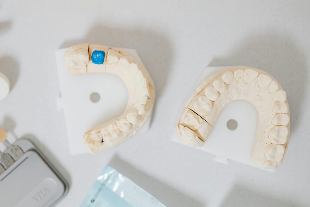 Close-up of dental molds on a white table, showcasing orthodontic details.
